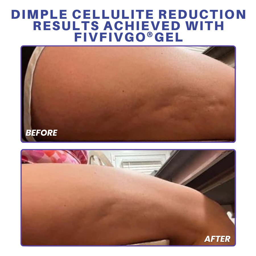 Fivfivgo® PDRN-GLP-1 Cellulite Targeting Reedle Shot Gel PRO