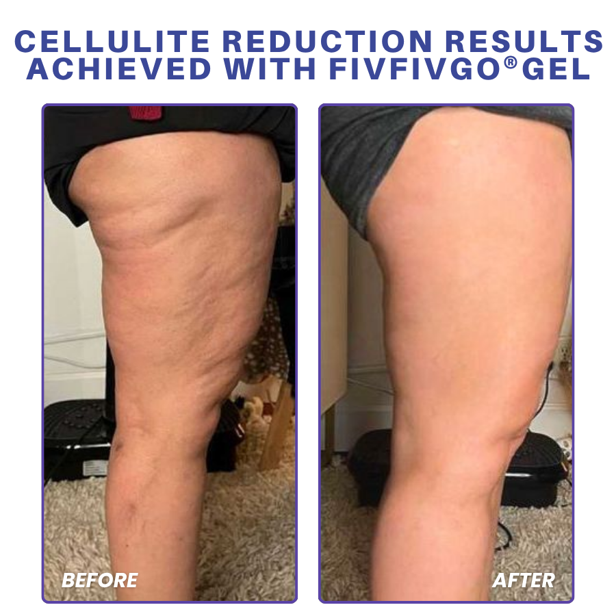 Fivfivgo® PDRN-GLP-1 Cellulite Targeting Reedle Shot Gel PRO