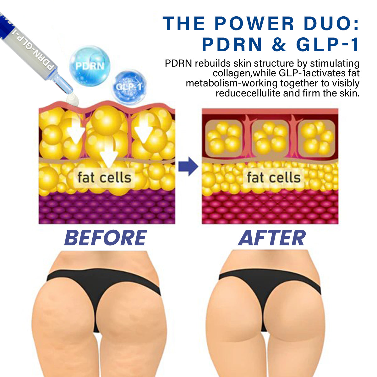 Oveallgo® PDRN-GLP-1 Slimming & Blood Sugar Regulating Reedle Shot Serum PRO
