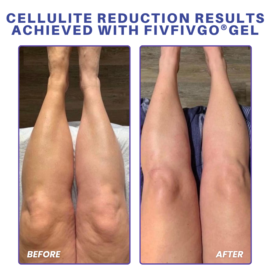 Fivfivgo® PDRN-GLP-1 Cellulite Targeting Reedle Shot Gel PRO