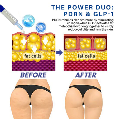 Oveallgo® PDRN-GLP-1 Slimming & Blood Sugar Regulating Reedle Shot Serum