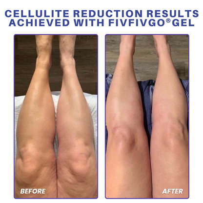 Fivfivgo® PDRN-GLP-1 Cellulite Targeting Reedle Shot Gel PRO